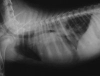 Radiografia del torace di un paziente con dotto arterioso pervio <br />